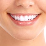 Teeth Whitening Treatment in Bandra